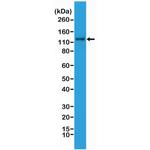 N-Cadherin Recombinant Rabbit Monoclonal Antibody (RM259)