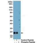 Phospho-MYL2 (Ser19) Recombinant Rabbit Monoclonal Antibody (RM484)