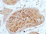 CD227 (Mucin 1) Antibody in Immunohistochemistry (Paraffin) (IHC (P))