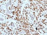 CD227 (Mucin 1) Antibody in Immunohistochemistry (Paraffin) (IHC (P))