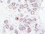 CD227 (Mucin 1) Antibody in Immunohistochemistry (Paraffin) (IHC (P))