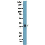 TIA-1 Recombinant Rabbit Monoclonal Antibody (RM490)