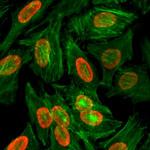 H3K9me2 Antibody in Immunocytochemistry (ICC/IF)