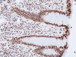 H3K9me2 Antibody in Immunohistochemistry (Paraffin) (IHC (P))