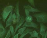 beta Tubulin Antibody in Immunocytochemistry (ICC/IF)