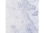 RNF168 Antibody in Immunohistochemistry (Paraffin) (IHC (P))