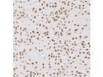 RNF168 Antibody in Immunohistochemistry (Paraffin) (IHC (P))