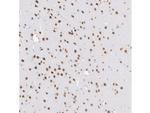 RNF168 Antibody in Immunohistochemistry (Paraffin) (IHC (P))