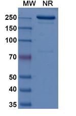 NPR1 (Imelciment Biosimilar) Recombinant Human Monoclonal Antibody