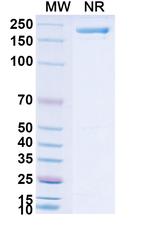 Tenascin C (Neuradiab Biosimilar) Recombinant Human Monoclonal Antibody