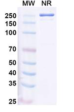 ZG16B (Ulenistamab Biosimilar) Recombinant Human Monoclonal Antibody