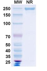 Vanalimab Humanized Antibody in SDS-PAGE (SDS-PAGE)