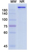 Ensomafusp Alfa Humanized Recombinant Human Monoclonal Antibody