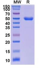 ACVRL1 (Dalantercept Biosimilar) Recombinant Human Monoclonal Antibody