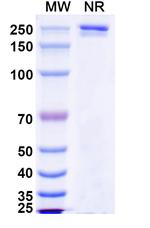 NGF (Luvagrobart Biosimilar) Recombinant Human Monoclonal Antibody