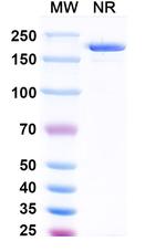 CD25 (Vopikitug Biosimilar) Recombinant Human Monoclonal Antibody