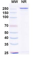 ST2 (Devextinetug Biosimilar) Recombinant Human Monoclonal Antibody