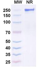 TCR V beta 9 (Seniprutug Biosimilar) Recombinant Human Monoclonal Antibody