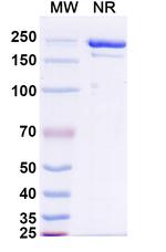 FucGM1 (Atigotatug Biosimilar) Recombinant Human Monoclonal Antibody