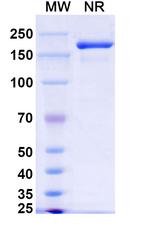 Xeligekimab Humanized Recombinant Human Monoclonal Antibody