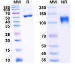 Ozekibart Recombinant Human Monoclonal Antibody