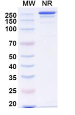 Lomvastomig Recombinant Human Monoclonal Antibody