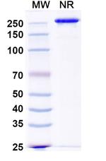 Ucenprubart Humanized Recombinant Human Monoclonal Antibody