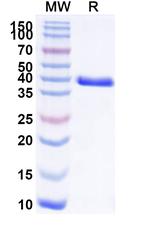 CEACAM6 Recombinant Human Monoclonal Antibody (L-DOS-47)