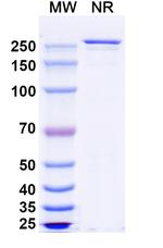Eurestobart Recombinant Human Monoclonal Antibody