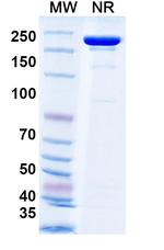 Tecotabart Humanized Recombinant Human Monoclonal Antibody
