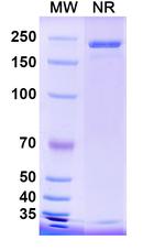 Trinbelimab Recombinant Human Monoclonal Antibody