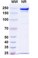 CD74 (STRO-001 Biosimilar) Recombinant Human Monoclonal Antibody