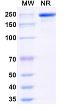 Plasma Kallikrein (Navenibart Biosimilar) Recombinant Human Monoclonal Antibody