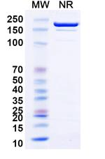 Tetanus Toxin (Siltartoxatug Biosimilar) Recombinant Human Monoclonal Antibody