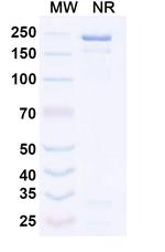 Hepatitis B Virus Surface Antigen (Tobevibart Biosimilar) Recombinant Human Monoclonal Antibody