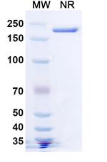 SARS-CoV-2 Spike Protein RBD (Lomtegovimab Biosimilar) Recombinant Human Monoclonal Antibody