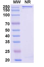 SARS-CoV-2 Spike Protein RBD (Enuzovimab Biosimilar) Recombinant Human Monoclonal Antibody