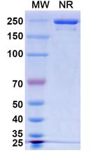 BK Virus VP1 (Traxivitug Biosimilar) Recombinant Human Monoclonal Antibody