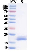 RSV Fusion Protein Antibody in SDS-PAGE (SDS-PAGE)