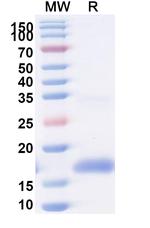 HIV1 gp120 VHH-8His-Cys-tag Antibody in SDS-PAGE (SDS-PAGE)