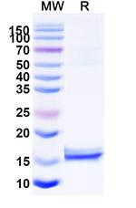 CD72 VHH-8His-Cys-tag Recombinant Alpaca Monoclonal Antibody (NbD4)