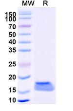 Cannabinoid Receptor 1 VHH-8His-Cys-tag Recombinant Alpaca Monoclonal Antibody (5G11)