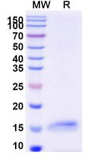 HSV Type 1 gD VHH-8His-Cys-tag Recombinant Alpaca Monoclonal Antibody (G44)