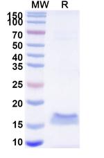 Metapneumovirus Fusion glycoprotein F0 VHH-8His-Cys-tag Recombinant Alpaca Monoclonal Antibody (SAA2194)