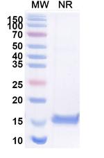 Nectin 2 VHH-8His-Cys-tag Recombinant Alpaca Monoclonal Antibody (SAA2116)