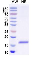 Nectin 2 VHH-8His-Cys-tag Recombinant Alpaca Monoclonal Antibody (SAA2117)