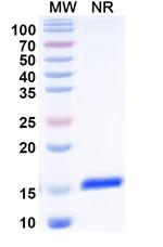 CD32 VHH-8His-Cys-tag Recombinant Alpaca Monoclonal Antibody (SAA2150)