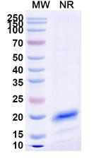CD45 VHH-8His-Cys-tag Recombinant Alpaca Monoclonal Antibody (2H7)