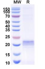 ARC VHH-Avi-8His-Cys-tag Recombinant Alpaca Monoclonal Antibody (E5#)