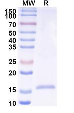 Parainfluenza Virus Type 1 VHH-8His-Cys-tag Recombinant Alpaca Monoclonal Antibody (SAA2104)
